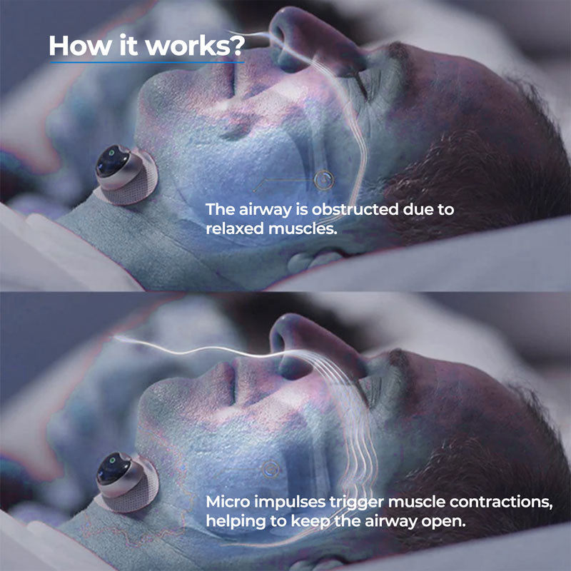 Anti-Snore Chin Clip Device for Quiet Sleep